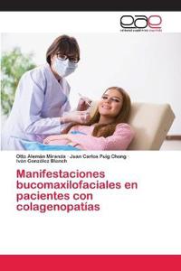 Manifestaciones bucomaxilofaciales en pacientes con colagenopatías