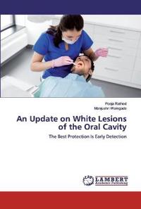 An Update on White Lesions of the Oral Cavity