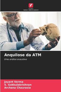 Anquilose da ATM