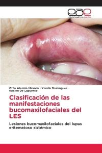 Clasificación de las manifestaciones bucomaxilofaciales del LES