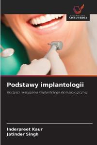 Podstawy implantologii