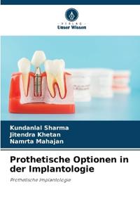 Prothetische Optionen in der Implantologie