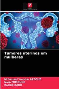 Tumores uterinos em mulheres