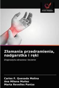 Zlamania przedramienia, nadgarstka i reki