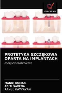 Protetyka SzczEkowa Oparta Na Implantach