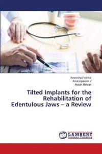 Tilted Implants for the Rehabilitation of Edentulous Jaws - a Review