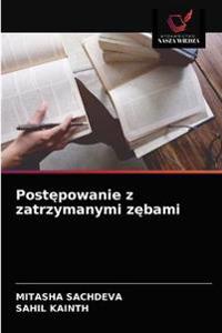 Postepowanie z zatrzymanymi zebami