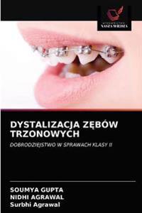 Dystalizacja ZEbów Trzonowych