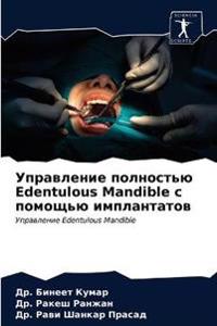 ?????????? ????????? Edentulous Mandible ? ??????? ??????&