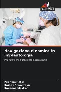 Navigazione dinamica in implantologia