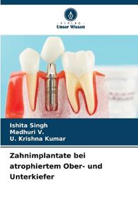 Zahnimplantate bei atrophiertem Ober- und Unterkiefer
