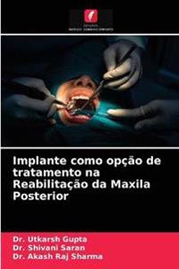 Implante como opção de tratamento na Reabilitação da Maxila Posterior