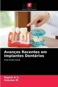 Avanços Recentes em Implantes Dentários