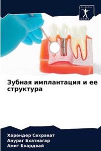 Зубная имплантация и ее структура