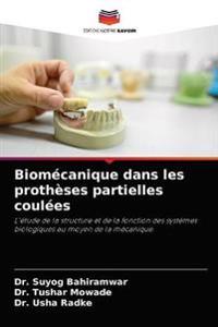 Biomécanique dans les prothèses partielles coulées