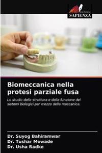 Biomeccanica nella protesi parziale fusa