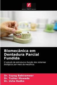 Biomecânica em Dentadura Parcial Fundida