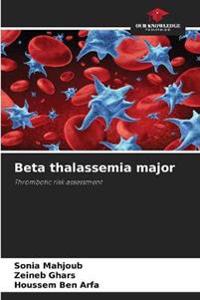 Beta thalassemia major