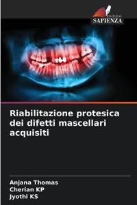 Riabilitazione protesica dei difetti mascellari acquisiti