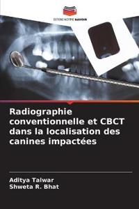 Radiographie conventionnelle et CBCT dans la localisation des canines impactées