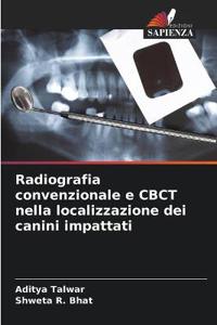 Radiografia convenzionale e CBCT nella localizzazione dei canini impattati