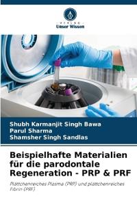 Beispielhafte Materialien für die parodontale Regeneration - PRP & PRF