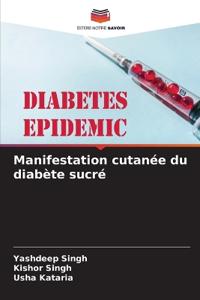 Manifestation cutan?e du diab?te sucr?