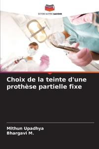 Choix de la teinte d'une prothèse partielle fixe