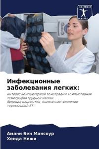 Инфекционные заболевания легких
