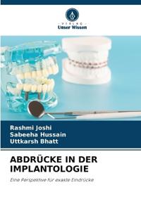 Abdrücke in Der Implantologie