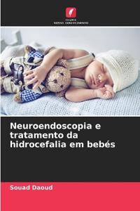 Neuroendoscopia e tratamento da hidrocefalia em bebés