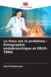 Le tissu est le problème