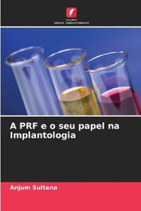 A PRF e o seu papel na Implantologia