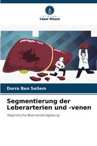 Segmentierung der Leberarterien und -venen