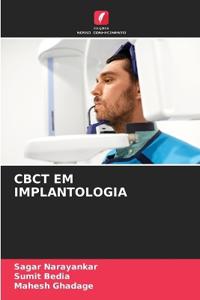 Cbct Em Implantologia