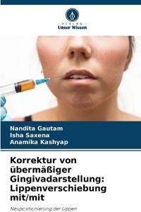 Korrektur von übermäßiger Gingivadarstellung