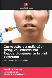 Correcção da exibição gengival excessiva