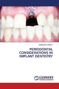 Periodontal Considerations in Implant Dentistry