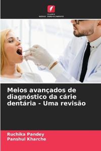 Meios avançados de diagnóstico da cárie dentária - Uma revisão