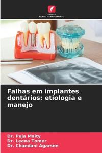 Falhas em implantes dentários