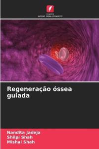 Regeneração óssea guiada
