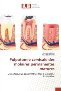 Pulpotomie cervicale des molaires permanentes matures