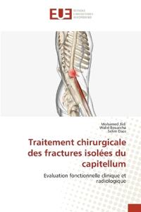 Traitement chirurgicale des fractures isolées du capitellum