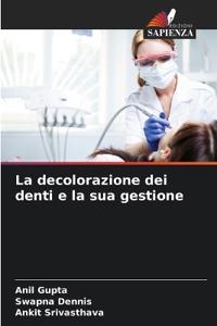 La decolorazione dei denti e la sua gestione