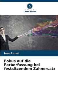 Fokus auf die Farberfassung bei festsitzendem Zahnersatz