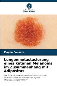 Lungenmetastasierung eines kutanen Melanoms im Zusammenhang mit Adipositas