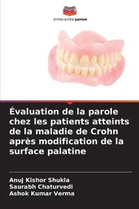 Évaluation de la parole chez les patients atteints de la maladie de Crohn après modification de la surface palatine