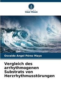 Vergleich des arrhythmogenen Substrats von Herzrhythmusstörungen