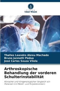 Arthroskopische Behandlung der vorderen Schulterinstabilität