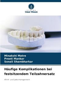 Häufige Komplikationen bei festsitzendem Teilzahnersatz